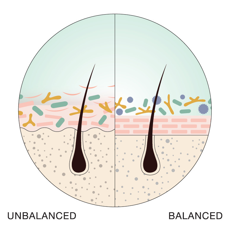 scalp illustration