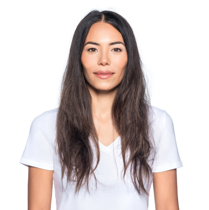 silverlight model before treatment